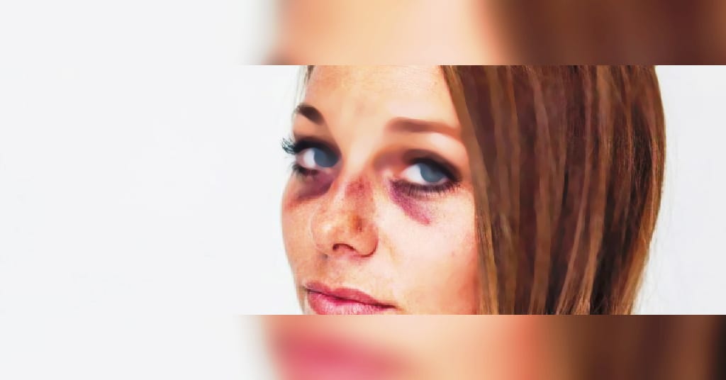 POLÍCIA PRENDE JOVEM QUE ESPANCOU MULHER DUAS VEZES EM MENOS DE 48 HORAS - News Rondônia