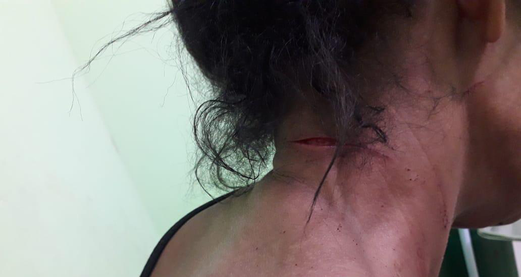 Jovem leva facada por membros de facção criminosa na zona leste da capital - News Rondônia