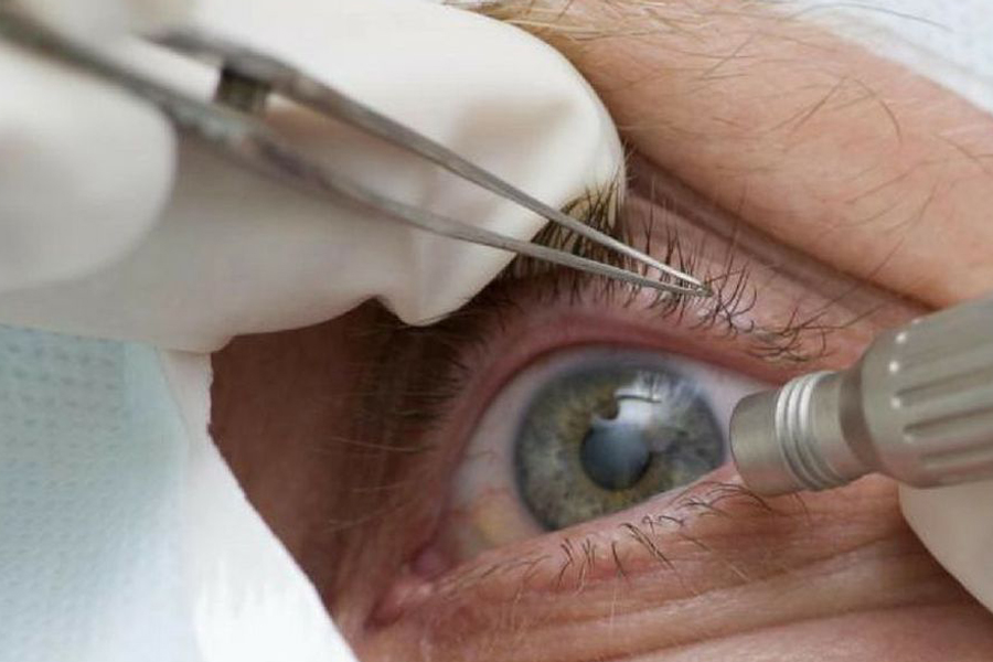 Pandemia faz cair detecção precoce de glaucoma - News Rondônia