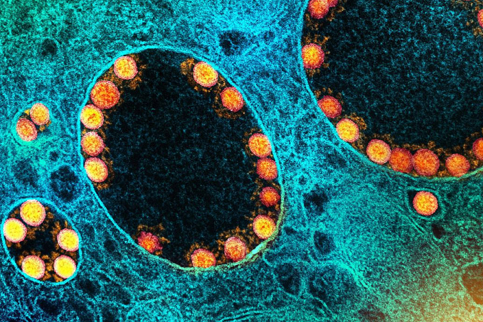 França identifica nova variante do coronavírus com mais de 40 mutações - News Rondônia