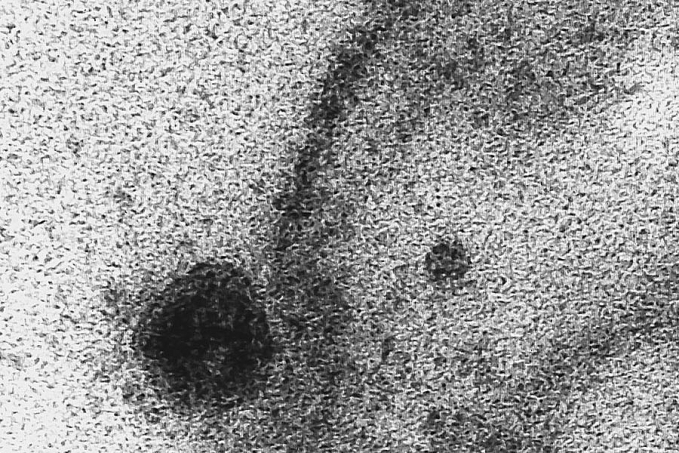 Novo coronavírus infecta e se replica em glândulas salivares - News Rondônia