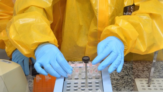 PREVISÃO: EMPRESAS APROVADAS PELA ANVISA PARA PRODUZIR TESTES DO CORONAVÍRUS PLANEJAM VENDA INICIAL DE 640 MIL KITS - News Rondônia