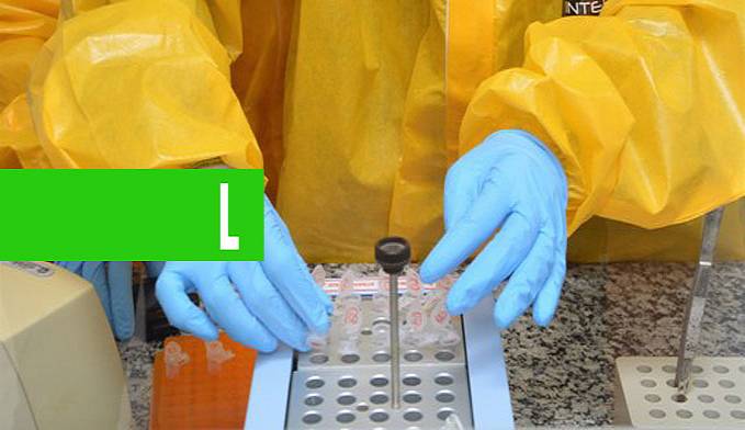 PREVISÃO: EMPRESAS APROVADAS PELA ANVISA PARA PRODUZIR TESTES DO CORONAVÍRUS PLANEJAM VENDA INICIAL DE 640 MIL KITS - News Rondônia
