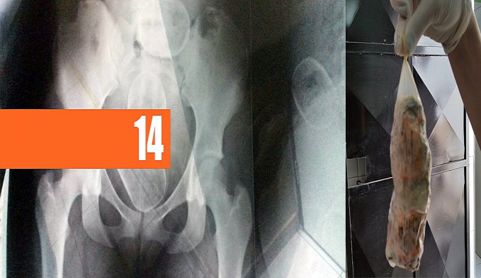 PARTES ÍNTIMAS  MULHER É DETIDA COM DROGA NO PRESÍDIO - News Rondônia