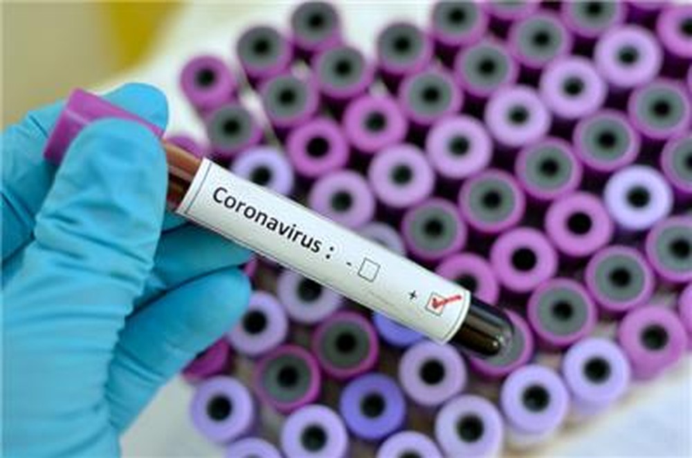 SUSPENSÃO: BRASIL ZERA TARIFA DE 61 PRODUTOS PARA TRATAMENTO OU PREVENÇÃO DO CORONAVÍRUS - News Rondônia