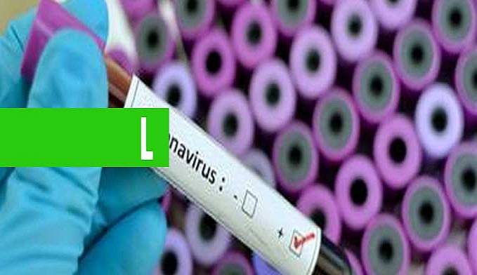 SUSPENSÃO: BRASIL ZERA TARIFA DE 61 PRODUTOS PARA TRATAMENTO OU PREVENÇÃO DO CORONAVÍRUS - News Rondônia