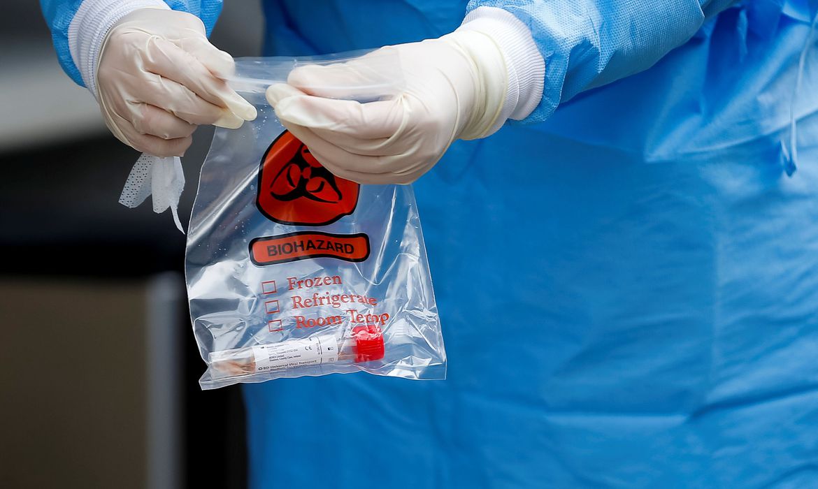 COVID-19: 500 MIL KITS DE TESTE RÁPIDO CHEGAM AO BRASIL - News Rondônia