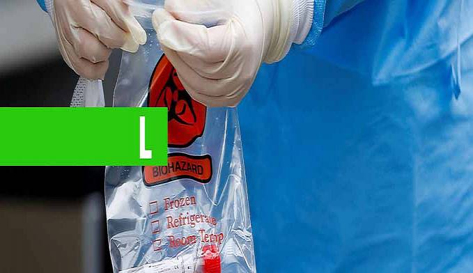 COVID-19: 500 MIL KITS DE TESTE RÁPIDO CHEGAM AO BRASIL - News Rondônia