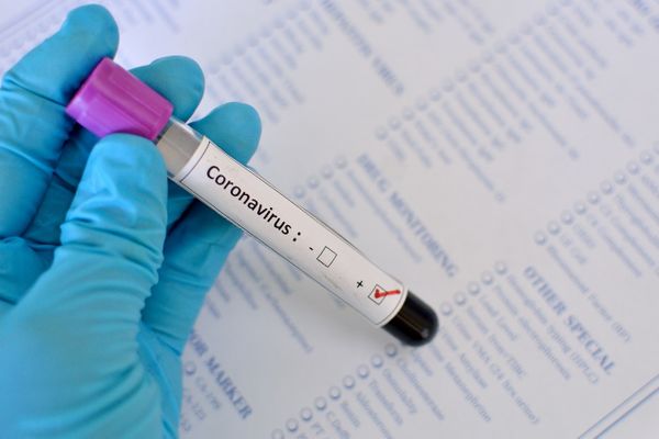 SECRETARIA DE SAÚDE DE JARU REALIZARÁ TESTE DA COVID-19 EM TODAS AS PESSOAS COM SINTOMAS DE GRIPE NO PRÓXIMO SÁBADO (06) - News Rondônia