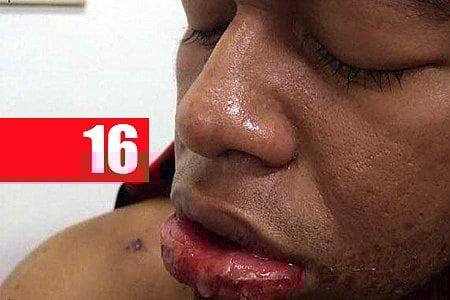 ZONA LESTE: JOVEM FAZ EX-NAMORADO ENGOLIR SODA CAUSTICA - News Rondônia