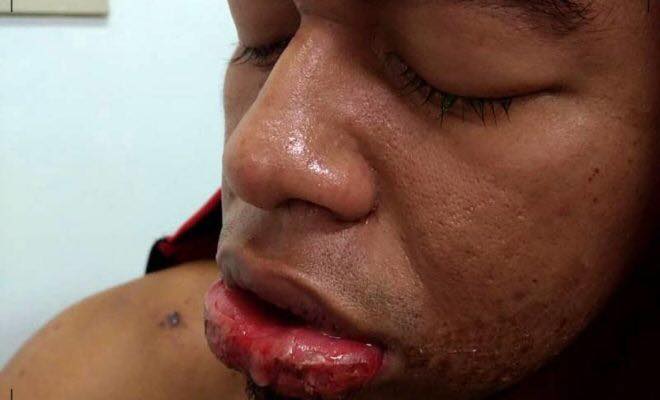 ZONA LESTE: JOVEM FAZ EX-NAMORADO ENGOLIR SODA CAUSTICA - News Rondônia