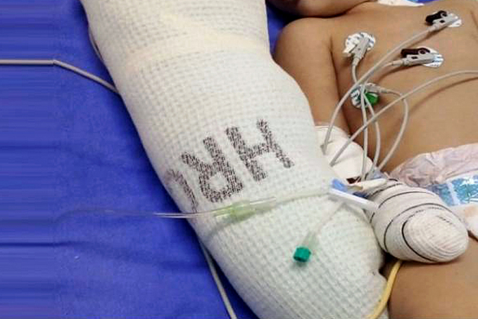 RECUPERAÇÃO - Bebê baleado na cabeça em Rondônia é transferido de hospital - News Rondônia