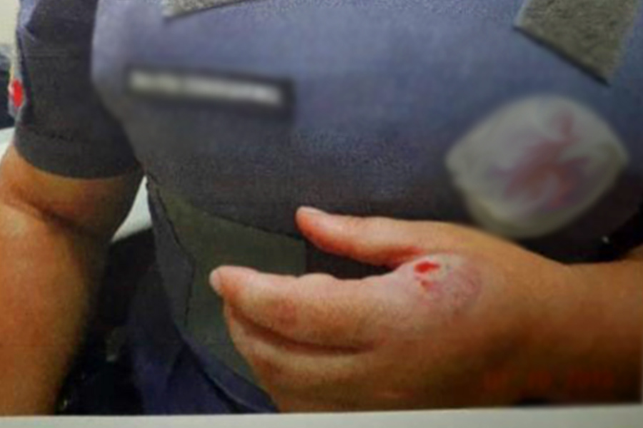 POLICIAL É ATACADO COM MORDIDAS E CABEÇADAS AO PRENDER HOMEM COM DROGA - News Rondônia