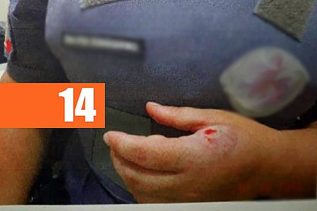POLICIAL É ATACADO COM MORDIDAS E CABEÇADAS AO PRENDER HOMEM COM DROGA - News Rondônia