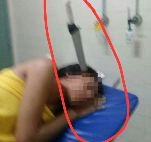 BRIGA DE IRMÃOS TERMINA COM FACA CRAVADA NA CABEÇA - IMAGEM FORTE - News Rondônia