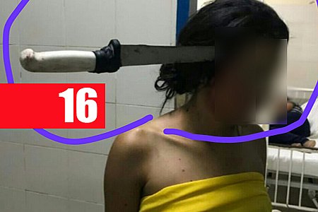 BRIGA DE IRMÃOS TERMINA COM FACA CRAVADA NA CABEÇA - IMAGEM FORTE - News Rondônia