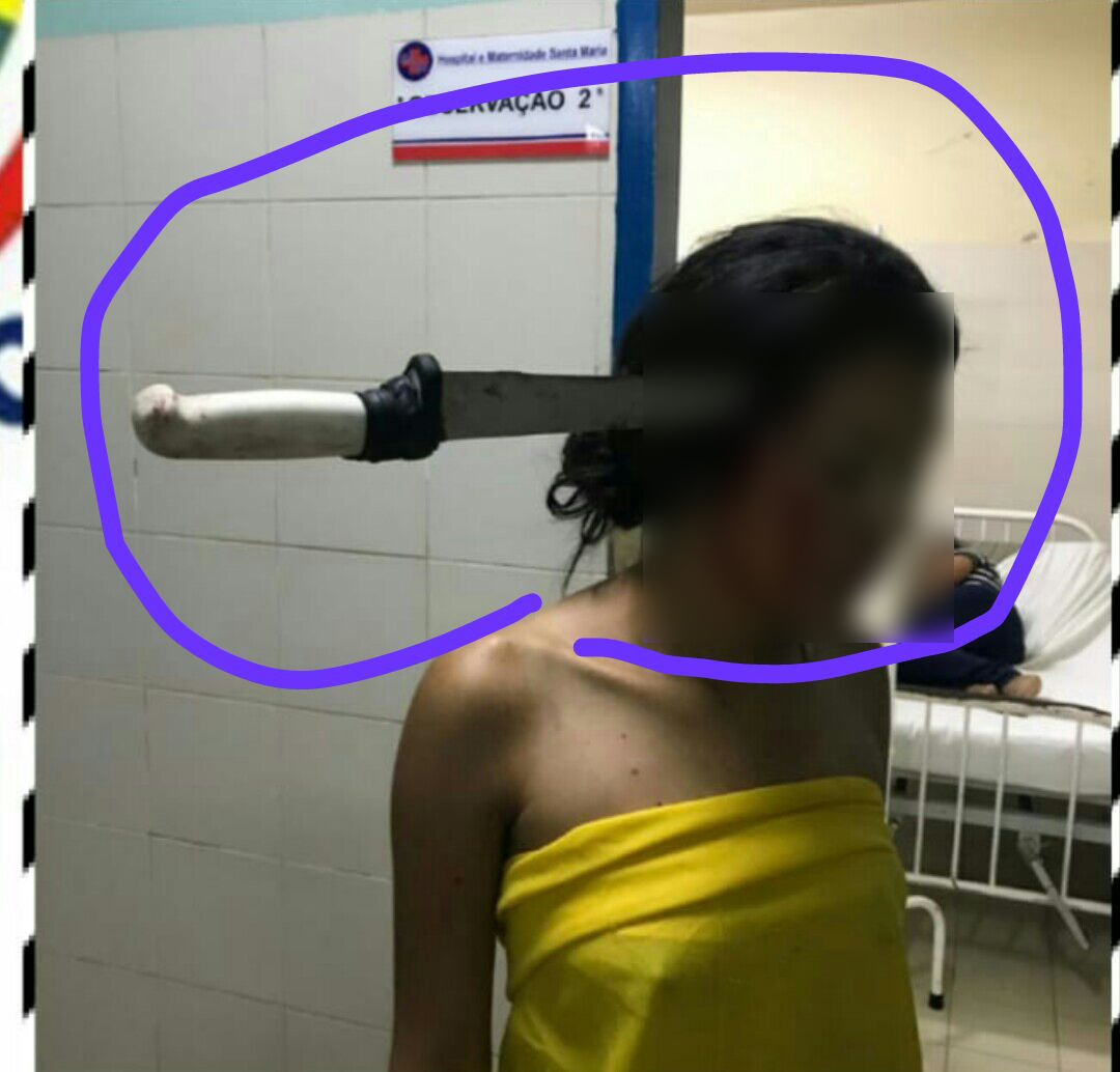 BRIGA DE IRMÃOS TERMINA COM FACA CRAVADA NA CABEÇA - IMAGEM FORTE - News Rondônia