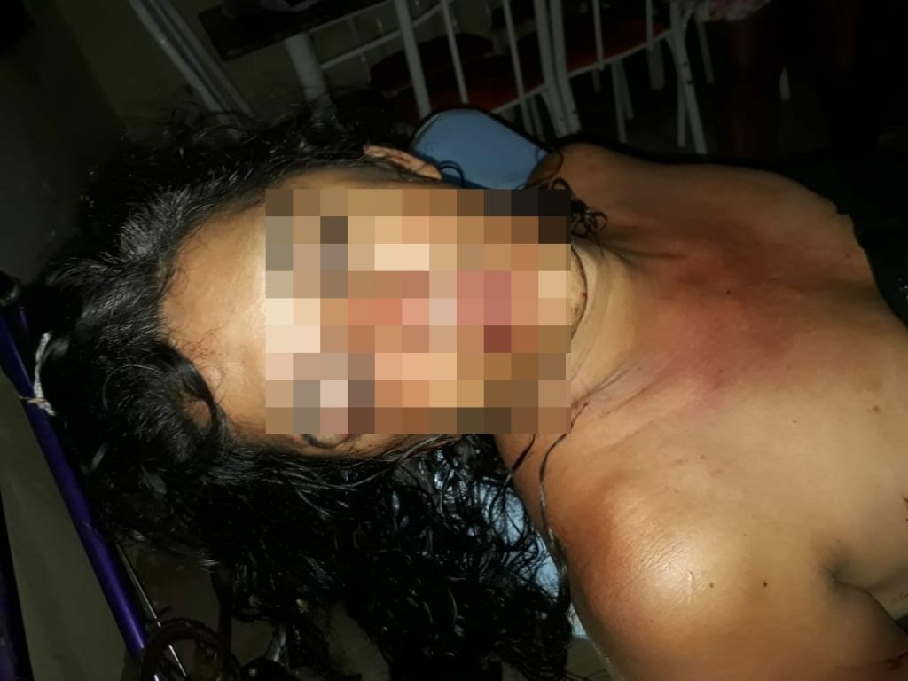 PIAUÍ: NA DELEGACIA, TRAVESTI MUDA DE VERSÃO E DIZ QUE FOI AGREDIDA POR RECUSAR RELACIONAMENTO - News Rondônia