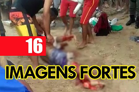 IMAGENS FORTES: HOMEM É ATACADO POR TUBARÃO NA PRAIA DE PIEDADE - News Rondônia