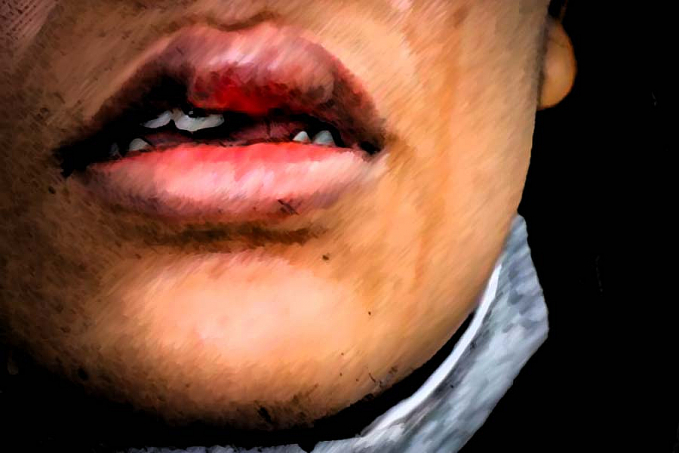 CIÚMES: Mulher é agredida com socos pelo ex-marido ao conversar no celular - News Rondônia