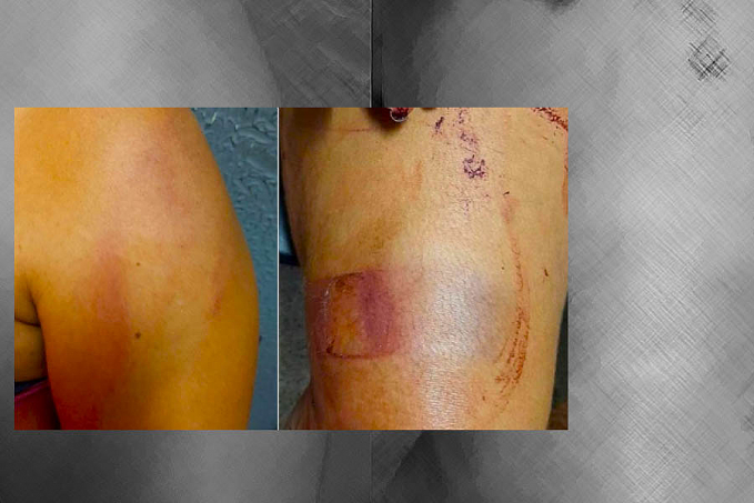 SEGUNDA CHANCE - Mulher perdoa marido e é agredida com facão - News Rondônia