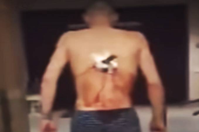 MAIS UM - Homem tem faca cravada nas costas em tentativa de assalto - News Rondônia