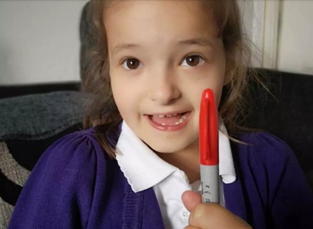 MENINA DE 6 ANOS DESENHA CATAPORA POR TODO CORPO NA TENTATIVA DE NÃO IR PARA A ESCOLA - News Rondônia