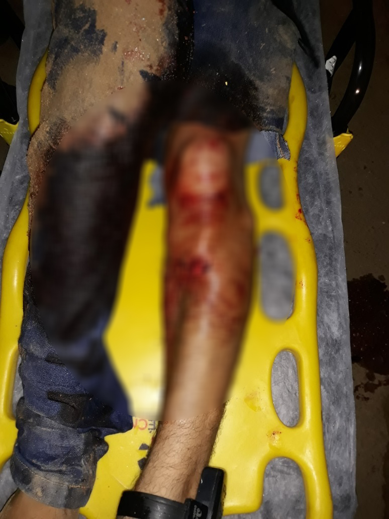 NA BALA  APENADO TROCA TIROS COM A POLÍCIA E LEVA A PIOR - VEJA FOTOS - News Rondônia