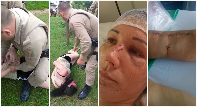 MULHER INOCENTE TEM A PERNA QUEBRADA POR PM EM AÇÃO IRREGULAR - News Rondônia