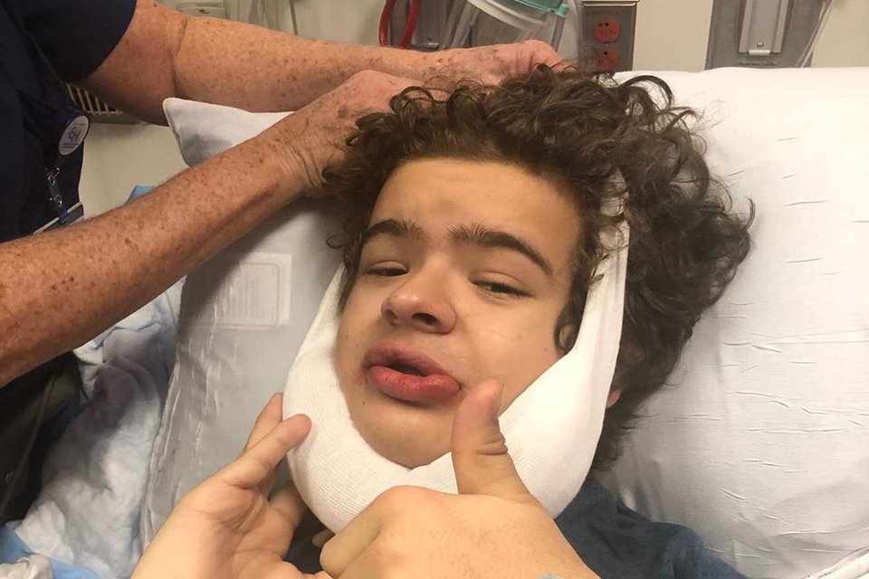 SÍNDROME RARA: GATEN MATARAZZO, O DUSTIN DE STRANGER THINGS, PASSA POR CIRURGIA - News Rondônia