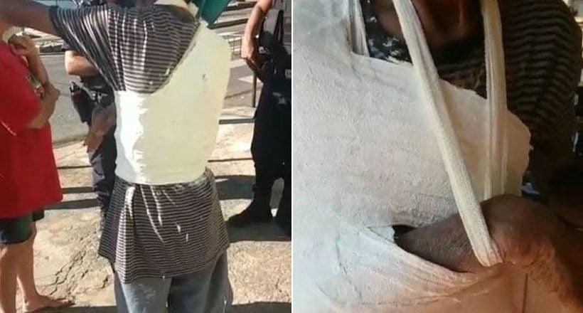 VÍDEO: IDOSO TEM BRAÇO E TRONCO ENGESSADOS POR CIMA DA CAMISA - News Rondônia