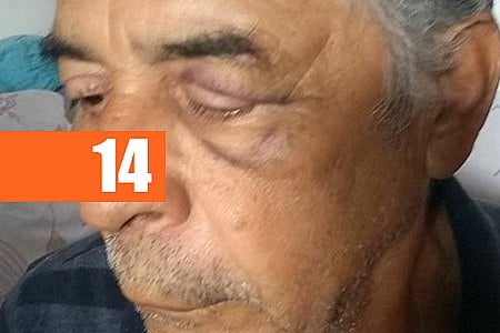 COVARDIA: IDOSO DE 67 ANOS É ESPANCADO POR PM; VEJA VÍDEO - News Rondônia