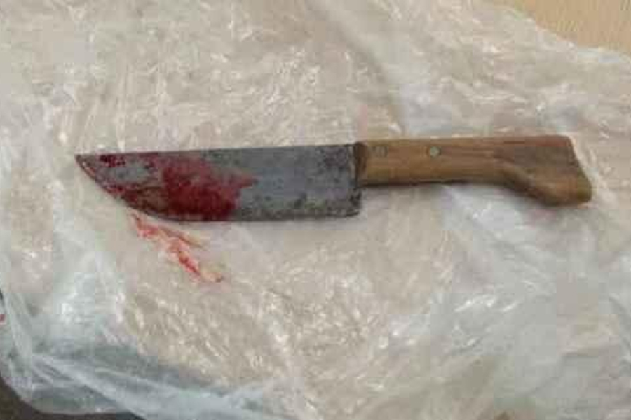 Homem dá 4 facadas em desafeto que 'ofendeu sua honra' - News Rondônia