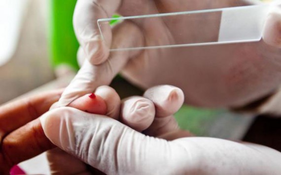 FIOCRUZ RONDÔNIA E CENTRO DE PESQUISA EM MEDICINA TROPICAL REALIZAM SIMPÓSIO EM ARBOVIROSES E MALÁRIA - News Rondônia