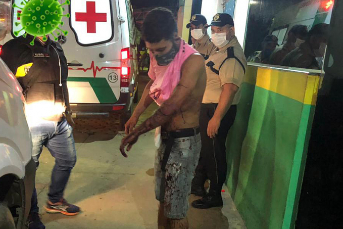Jovem leva facada no braço e pescoço durante briga com vizinho na zona leste - News Rondônia