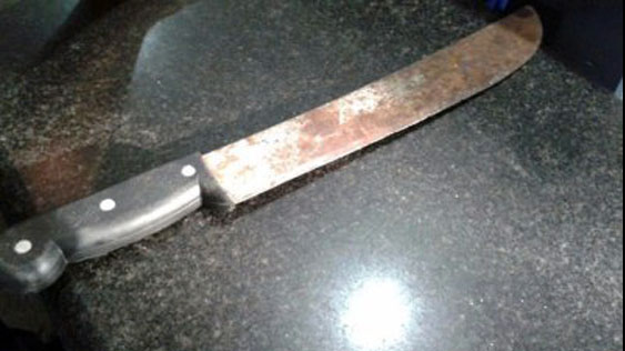 DISCUSSÃO ENTRE MULHERES TERMINA COM AGRESSÃO A GOLPES DE FACÃO - News Rondônia
