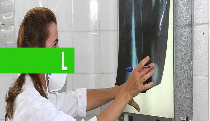 COVID-19: PESQUISADORES VÃO TESTAR VACINA CONTRA TUBERCULOSE - News Rondônia