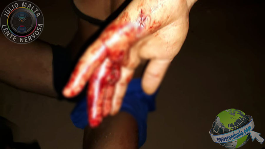 PUNIÇÃO: USUÁRIA DE DROGAS LEVA TIRO NA MÃO APÓS SER ACUSADA DE ROUBO - News Rondônia