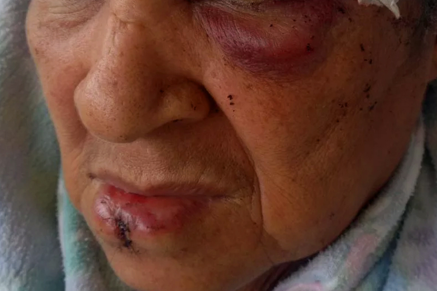 NAS ALTURAS - Vizinho espanca mulher que se incomodou com som alto - News Rondônia