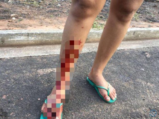 Após discussão, idosa agride e tortura adolescente em Candeias do Jamari - News Rondônia