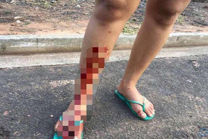 Após discussão, idosa agride e tortura adolescente em Candeias do Jamari - News Rondônia