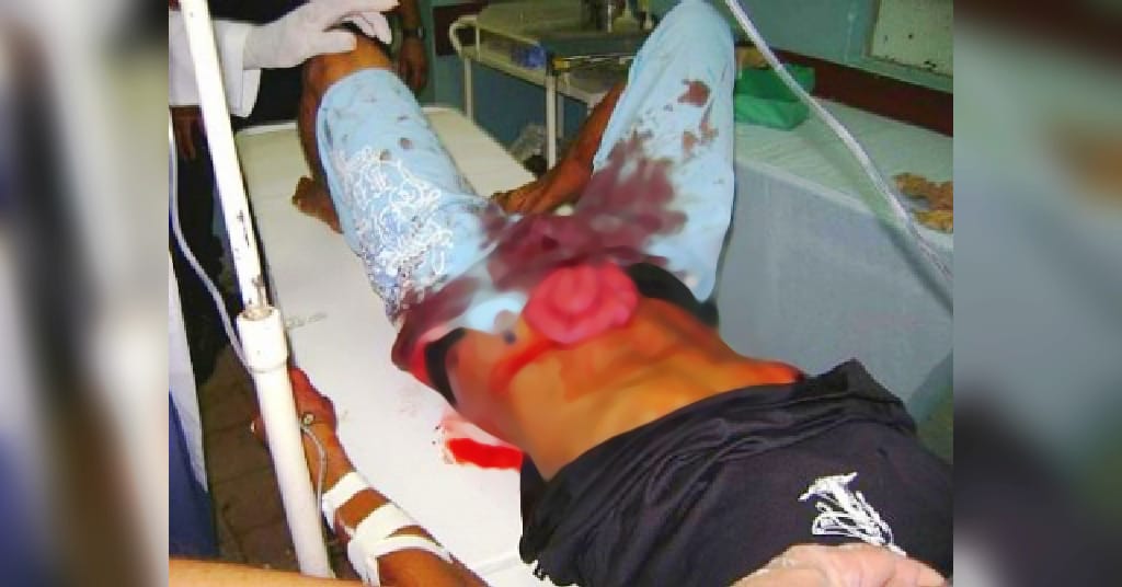 CIÚMES: CASAL É ATACADO COM GOLPES DE FACA E FICA COM VÍSCERAS EXPOSTAS - News Rondônia