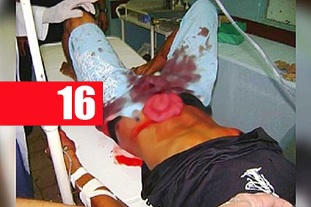 CIÚMES: CASAL É ATACADO COM GOLPES DE FACA E FICA COM VÍSCERAS EXPOSTAS - News Rondônia