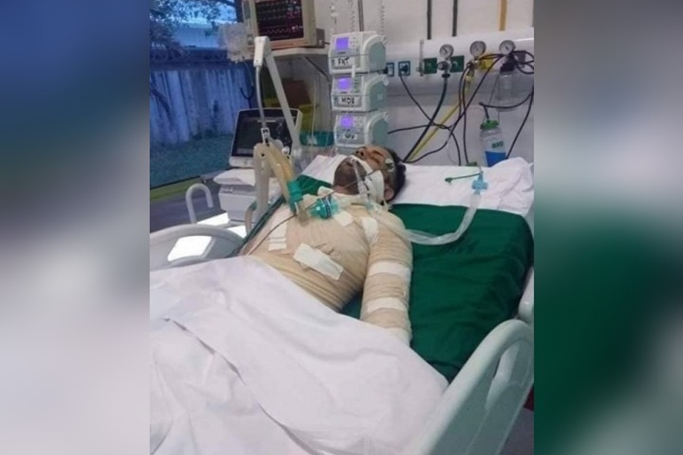 HOMEM MORRE APÓS TER 40% DO CORPO QUEIMADO PELA EX-NAMORADA - News Rondônia
