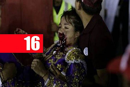 IMAGENS FORTES! TOUREIRA FICA GRAVEMENTE FERIDA APÓS LEVAR CHIFRADA NO ROSTO - News Rondônia
