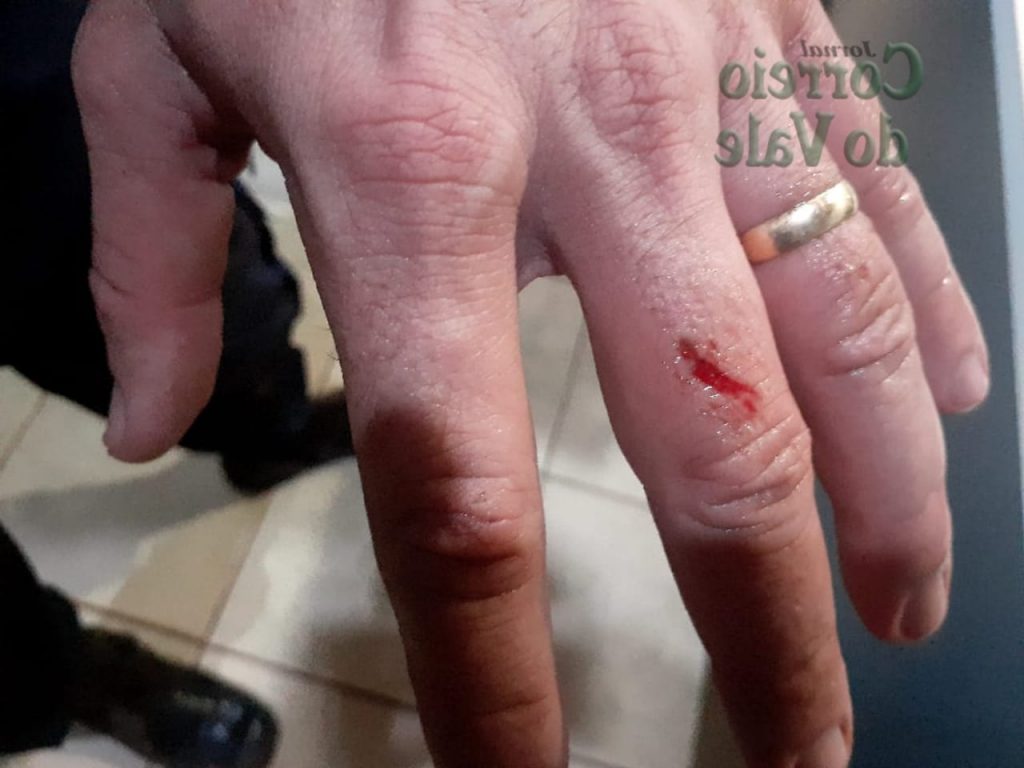 ENDIABRADO - Suspeito de aliciar crianças tenta matar policiais com golpes de foice - News Rondônia