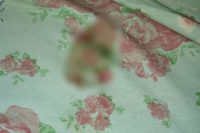 Bebê de 1 ano é estuprada pelo pai e precisa passar por cirurgia - News Rondônia