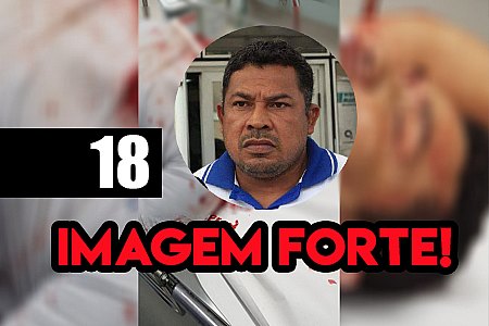 REBELIÃO: AGENTE PENITENCIÁRIO É SOCORRIDO COM CHUNCHO NO PESCOÇO E MORRE NO HOSPITAL - IMAGEM FORTE - News Rondônia
