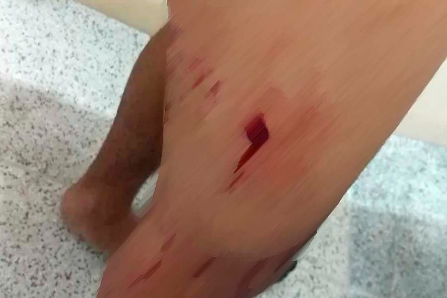 FUGA ALUCINADA - Foragido da justiça ataca policiais e leva tiro - News Rondônia