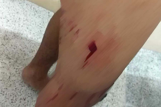 FUGA ALUCINADA - Foragido da justiça ataca policiais e leva tiro - News Rondônia